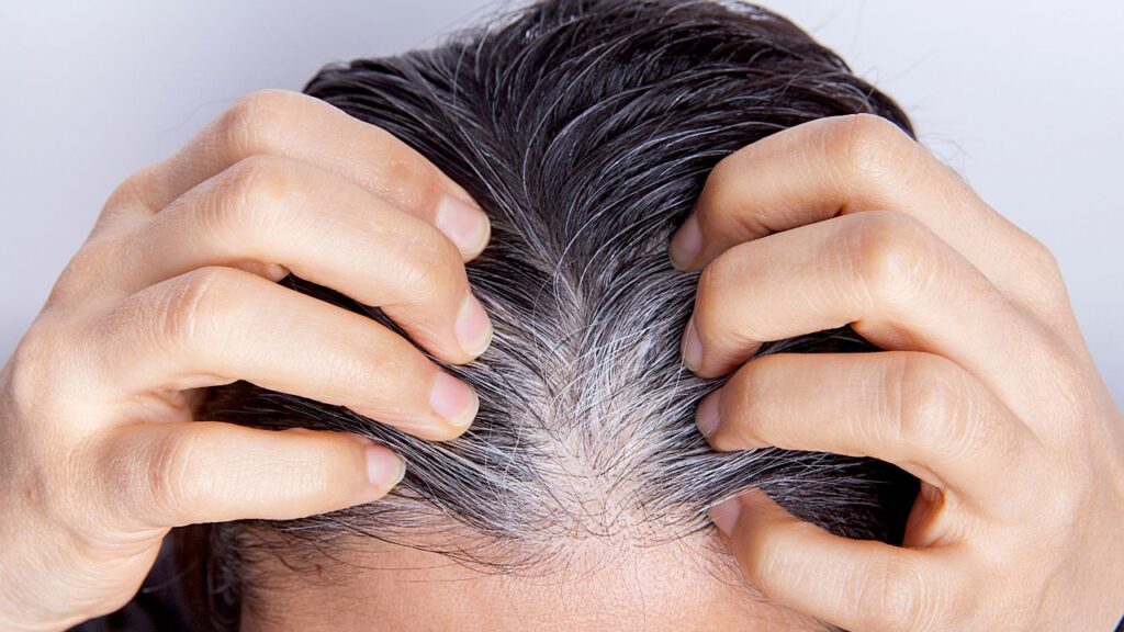 White Hair