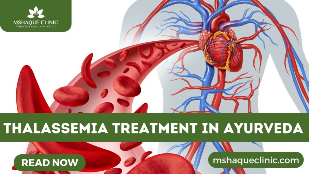 Thalassemia Treatment In Ayurveda