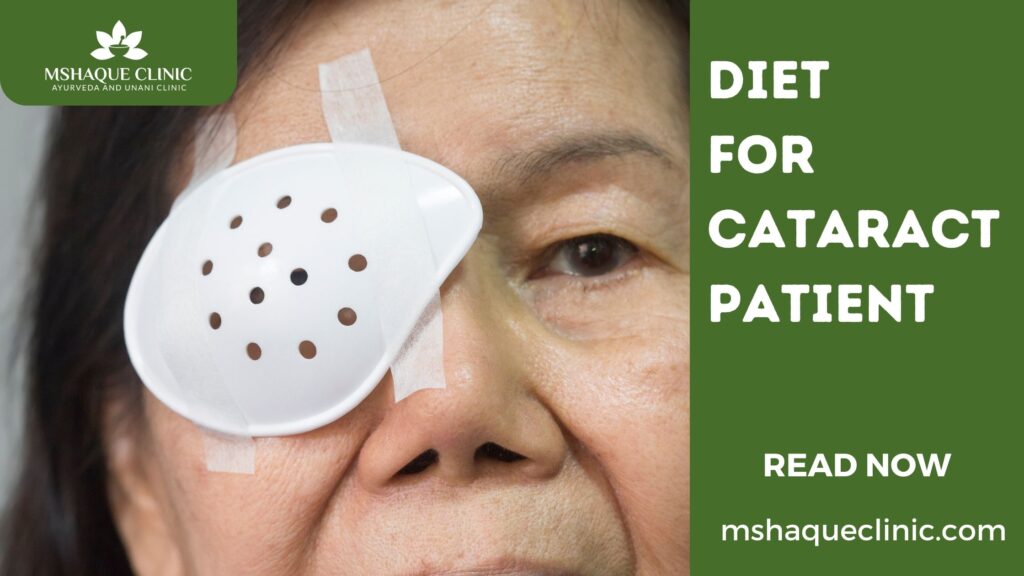 Diet For Cataract Patient