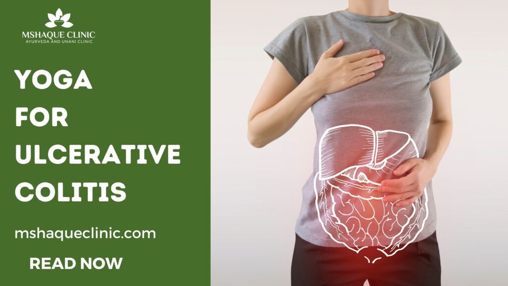 Yoga For Ulcerative Colitis