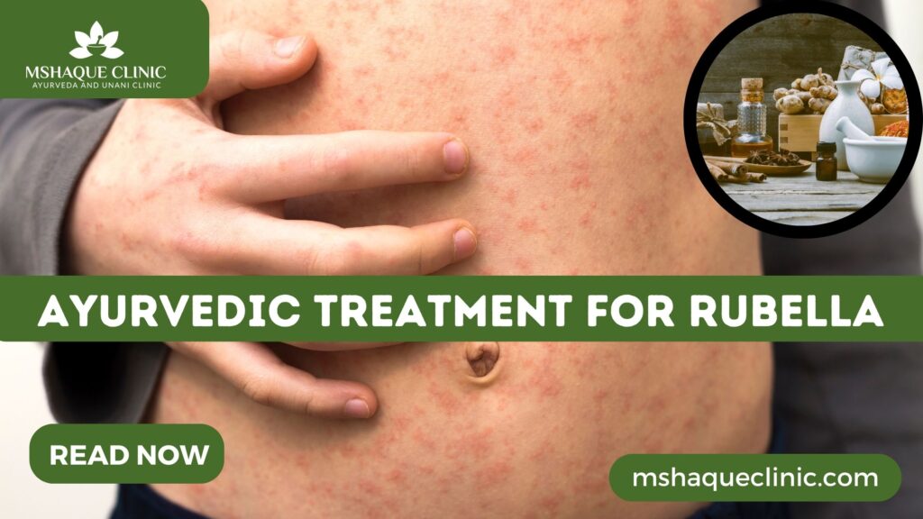 Ayurvedic Treatment For Rubella