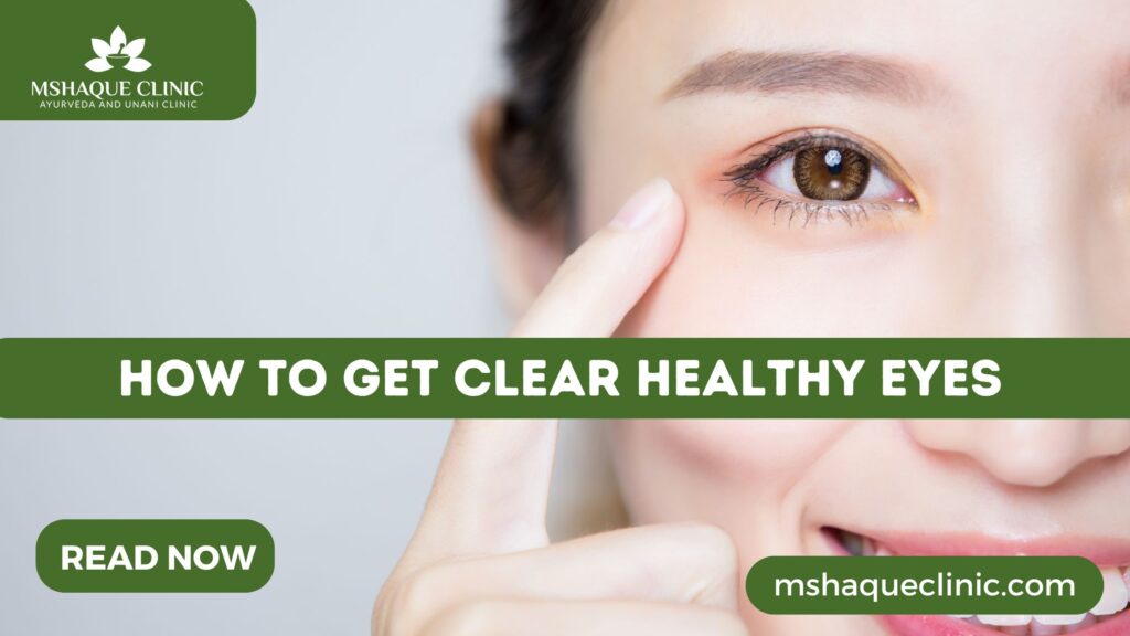 How To Get Clear Healthy Eyes